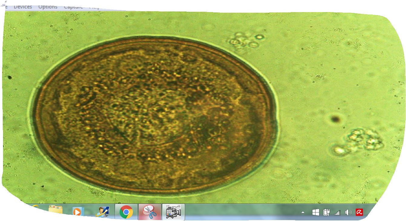 vorticella?